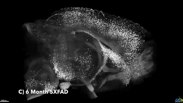 The Deep Brain Origins of Alzheimer’s Disease