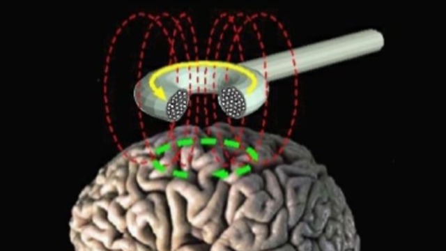 New Research Shows That Human Working Memory can be Tweaked With Non-Invasive Magnetic Stimulation