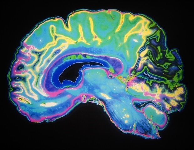 Researchers make breakthrough in understanding cause of rare childhood brain disorders