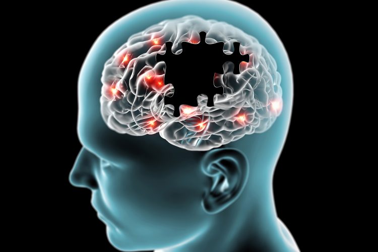 Study identifies pathway responsible for blood-brain barrier impairment in Alzheimer’s