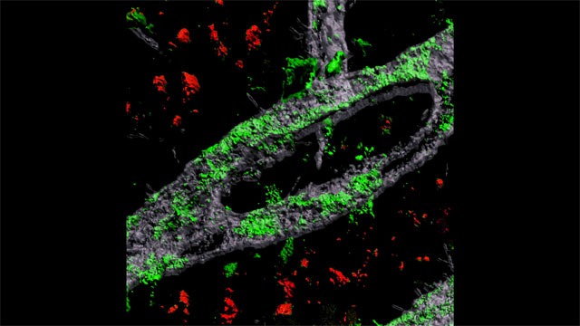 Blood-Brain Barrier-in-a-Dish Leads to Alzheimer's Discovery