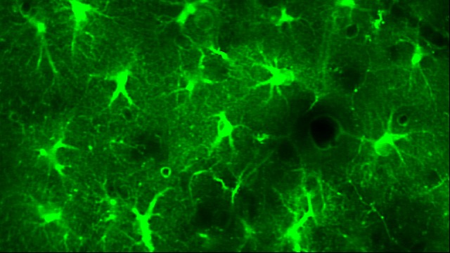 Astrocytes Play an Important Role in Maintaining Slow Wave Sleep