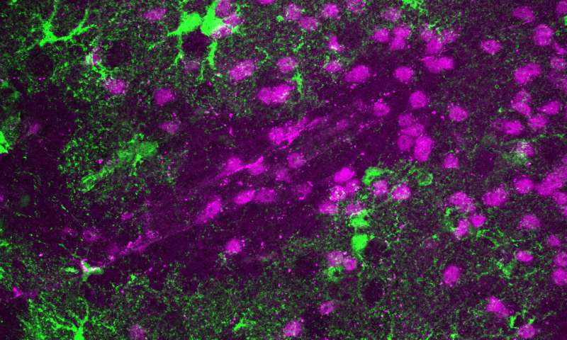 Scientists advance understanding of blood-brain barrier health