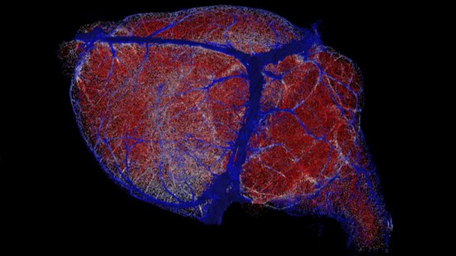 Blood Vessel Map Reveals How Brain Gets Food for Thought