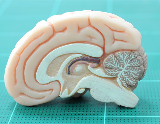 Pig brain atlas gives a more precise view of human brain
