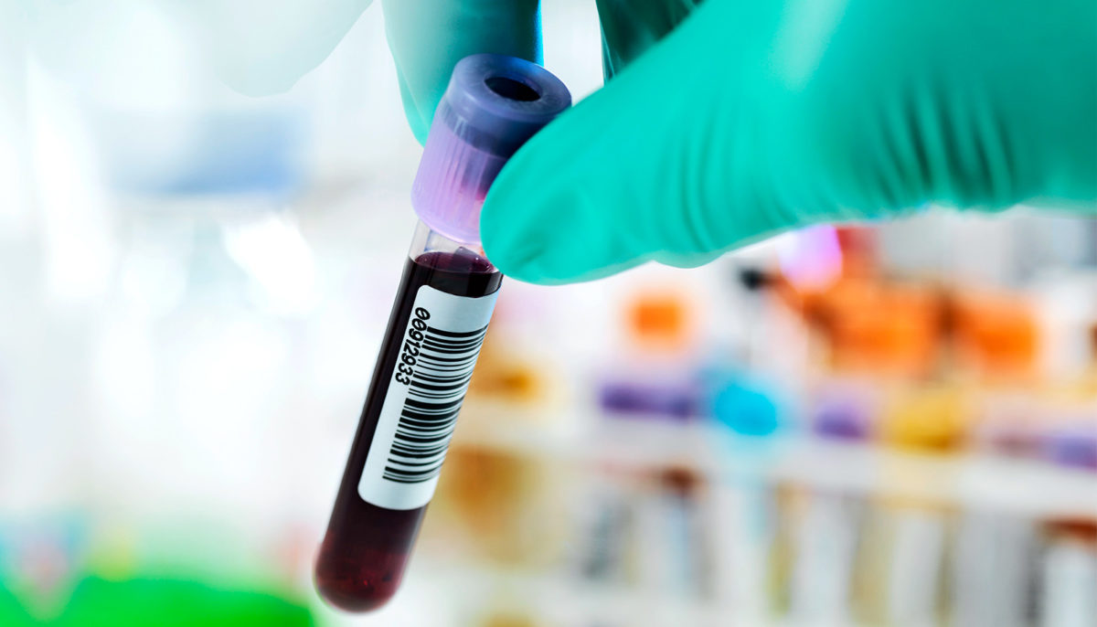 Blood test for depression could personalize treatment