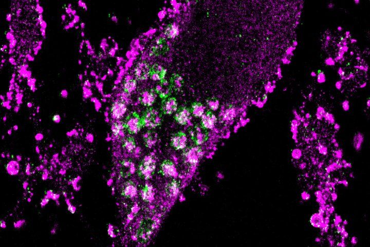 Full-Genome CRISPR Screen Reveals Surprsing Ways Neurons Survive Oxidative Stress
