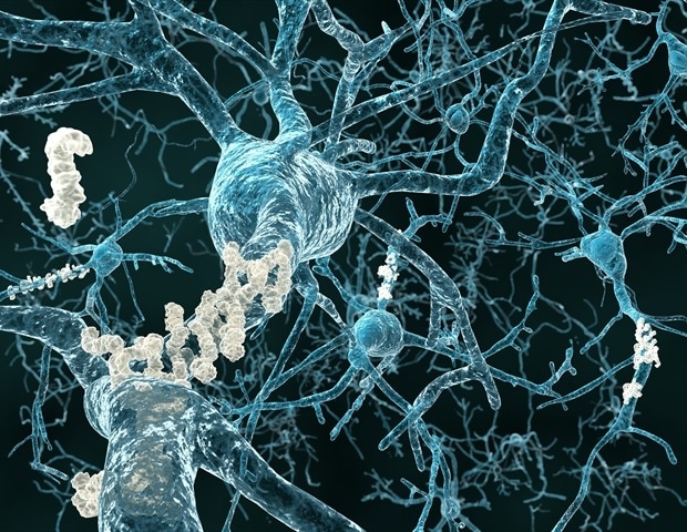 Novel imaging method used to map glycosylation patterns linked with Alzheimer’s disease