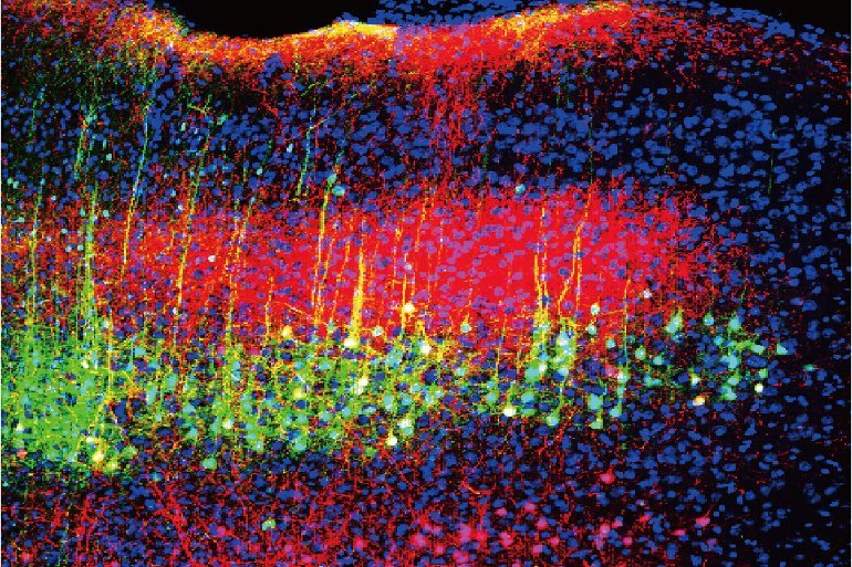 How Sound Reduces Pain in Mice