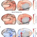 A New Collection of Human Brain Atlases That Chart Postnatal Development