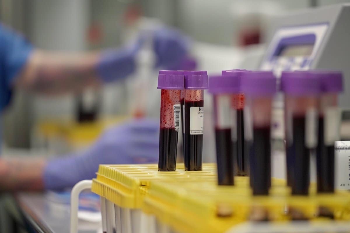 UK to Begin Nationwide Blood Test Trials for Dementia
